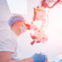 Cataract Surgery Australia